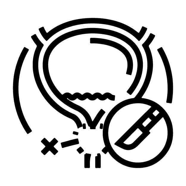 Prostatectomy - NU Hospitals