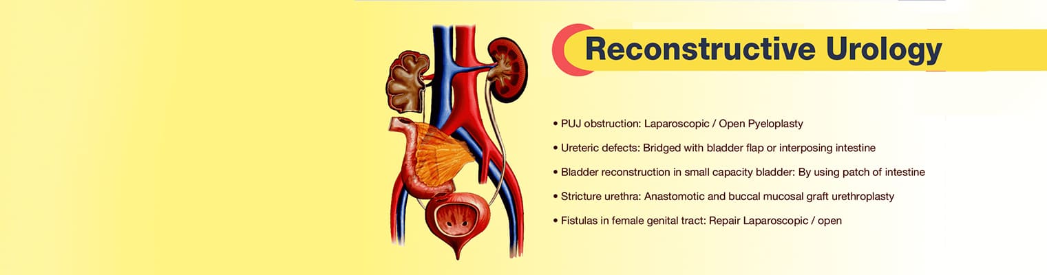 Reconstructive Urology - NU Hospitals