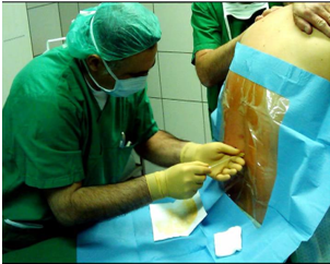 Spinal and Epidural Anesthesia - NU Hospitals