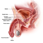 Male Urethral Stricture Disease - NU Hospitals