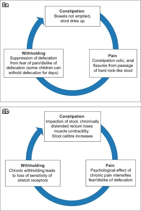 Vicious Cycle of Constipation in Children - NU Hospitals