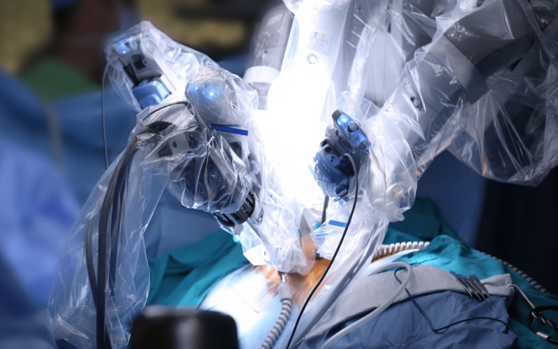 Robotic Urology Surgery - NU Hospitals