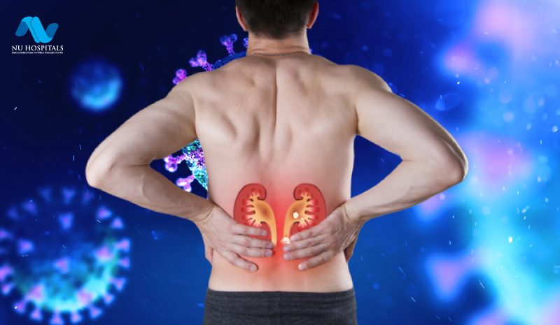 COVID-19 and Kidney Disease