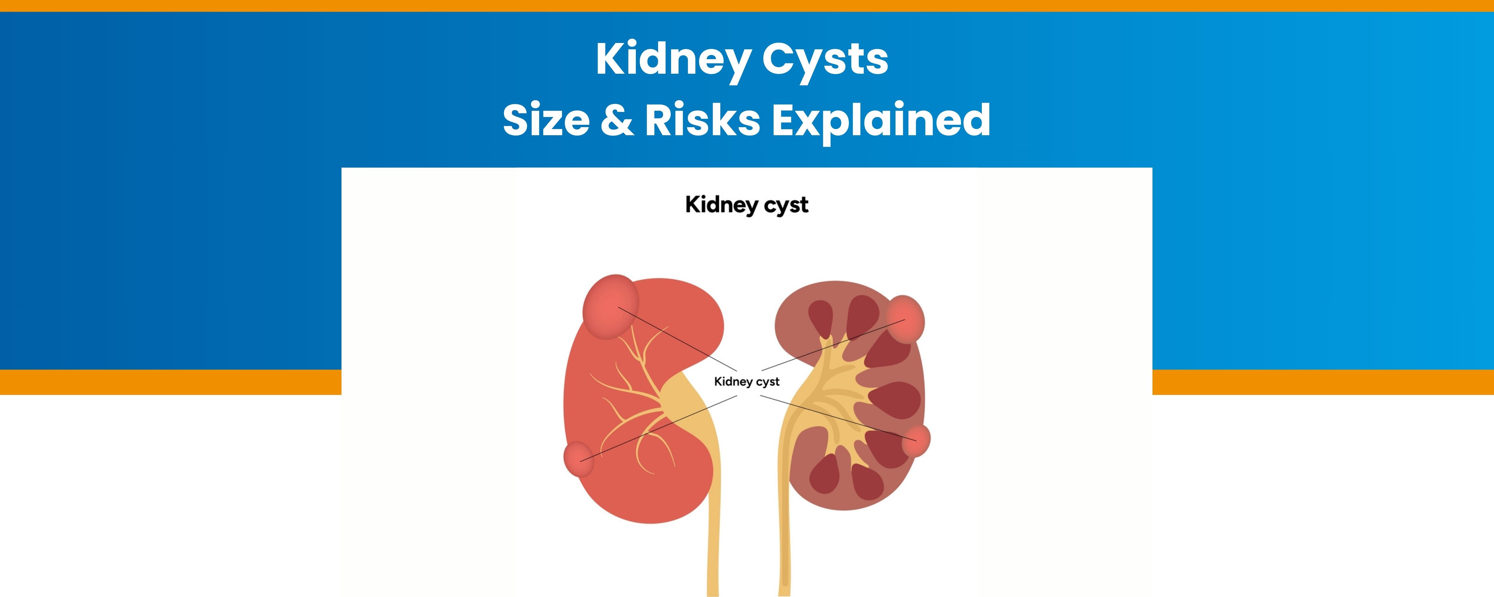 Kidney Cysts: Size and Risks Explained