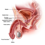 Male Urethral Stricture Disease