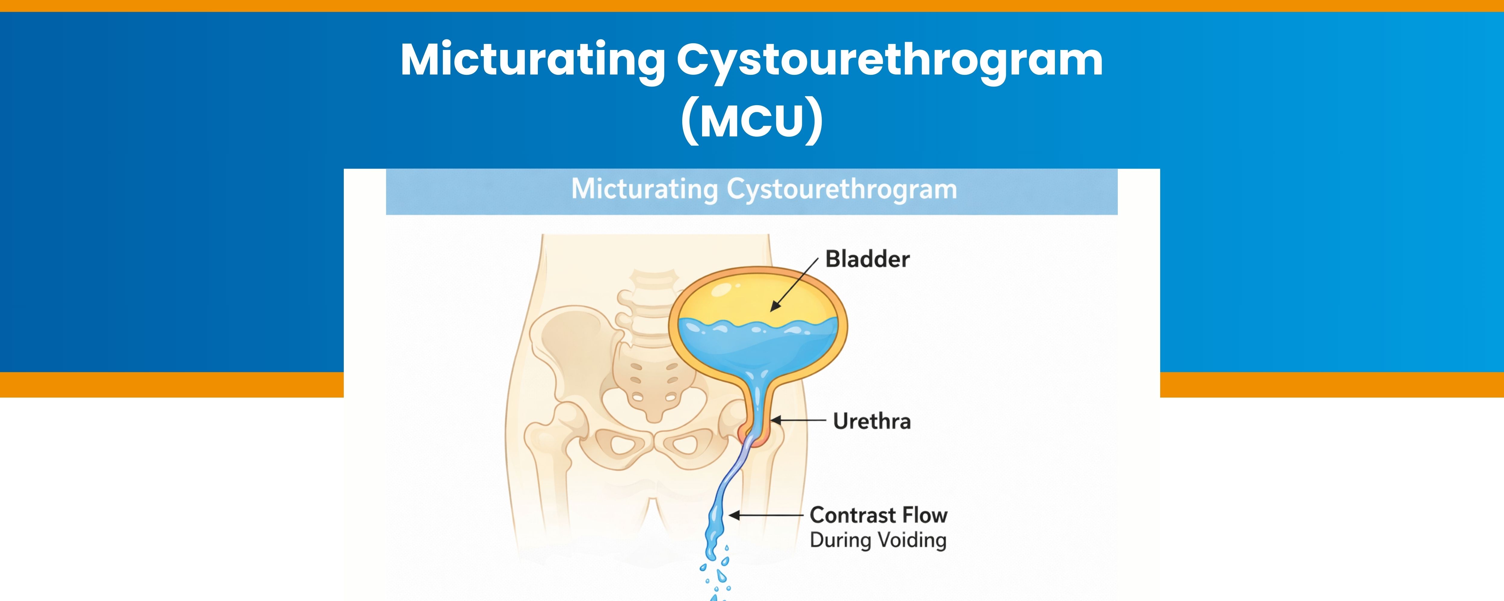 Micturating Cystourethrogram (MCU)