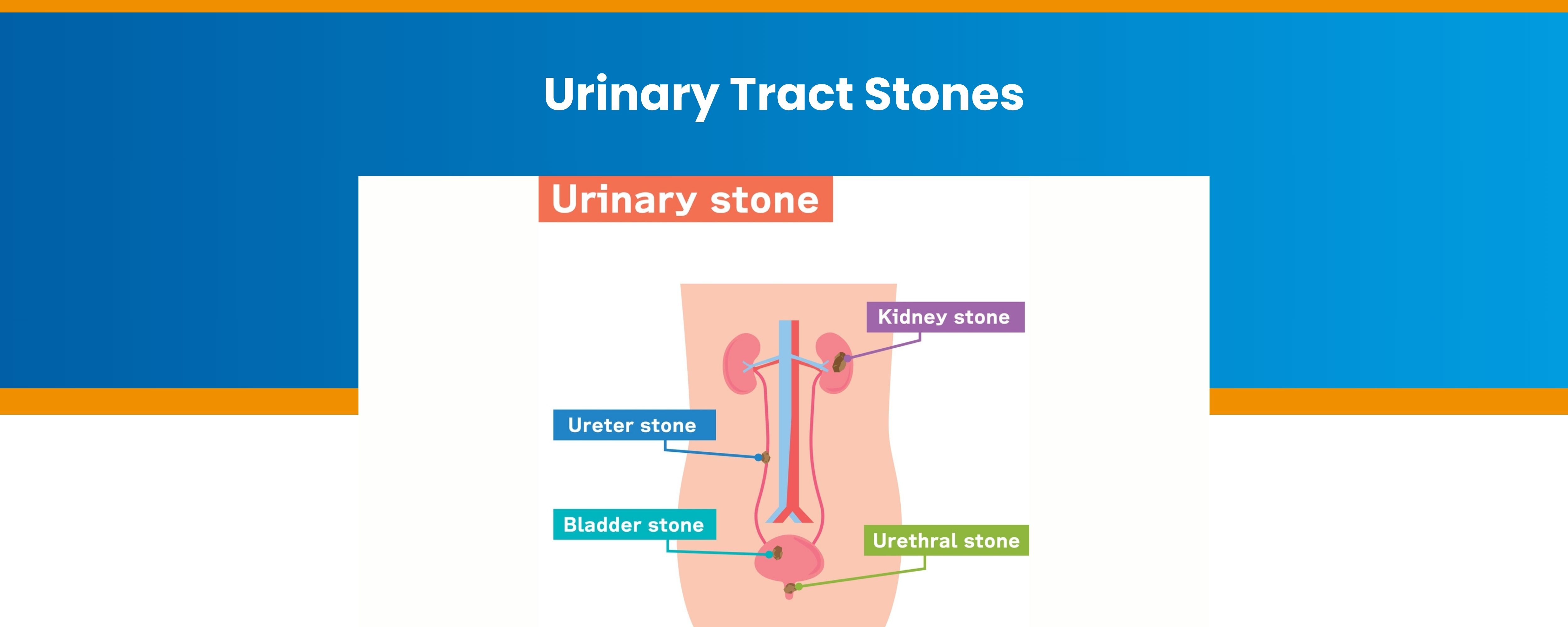 Urinary Tract Stones