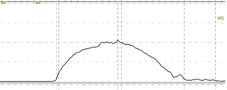 UROFLOWMETRY