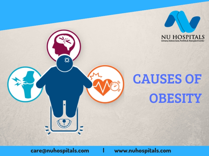 CAUSES OF OBESITY